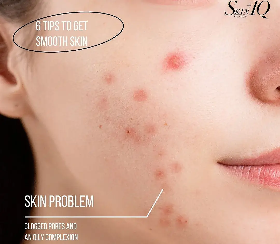 Smooth Skin: Our Top 6 Tips